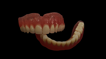 vinayaga dental lab Ordinary Denture-vinayaga dental lab